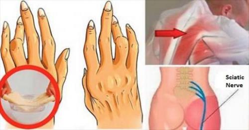 Как этот маленький трюк помогает справиться с артритом. Этот малоизвестный простой трюк поможет вам бороться с артритом, радикулитом и болью в спине лучше, чем любые обезболивающие!