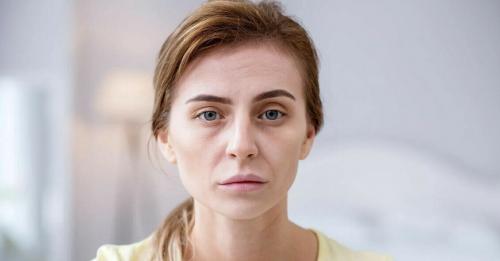 Побочные эффекты: разгадаем тайну темных кругов и мешков под глазами 01 Побочные эффекты: разгадаем тайну темных кругов и мешков под глазами 01