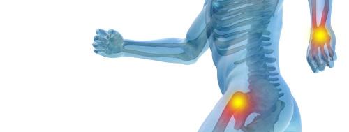 Какие другие методы лечения суставов рук могут быть использованы вместе с касторовым маслом. Лечим суставы и снимаем спазмы касторовым маслом