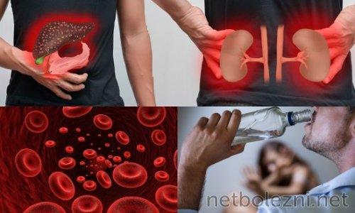 Лекарства для лечения коронавирусной инфекции: что известно о них 02 Лекарства для лечения коронавирусной инфекции: что известно о них 02