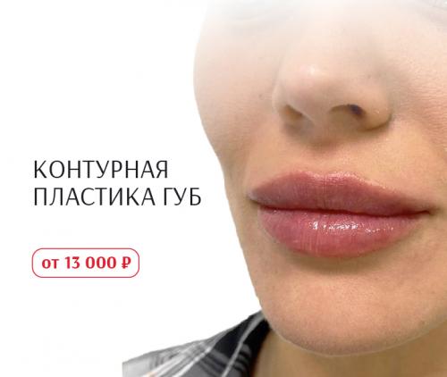 Отказаться от черных точек на носу: лучшие средства и методы 02