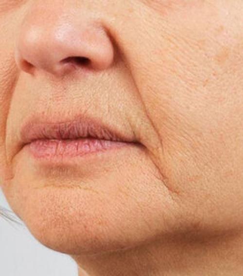 Отличное масло для устранения морщин вокруг носа и рта 01