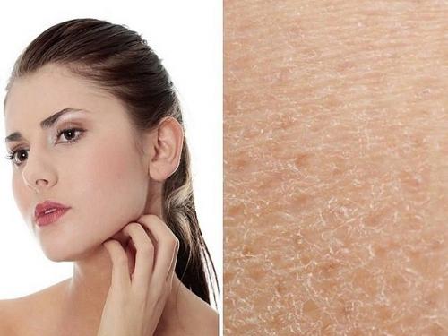 Лосьон или тоник для лица. Что такое тоник? 03