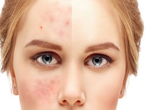 Чем отличается лосьон для лица от тоника.. Чем отличается тоник от лосьона для лица? 04 Чем отличается лосьон для лица от тоника.. Чем отличается тоник от лосьона для лица? 04