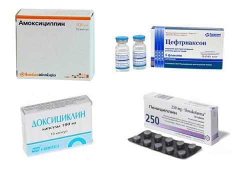 Мазь для суставов колен. Антибактериальная терапия при септических артритах