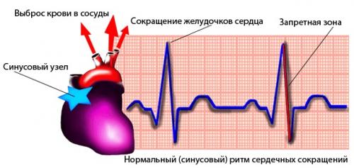 Лечение нарушений ритма сердца. Фибрилляция и трепетание предсердий 02 Лечение нарушений ритма сердца. Фибрилляция и трепетание предсердий 02