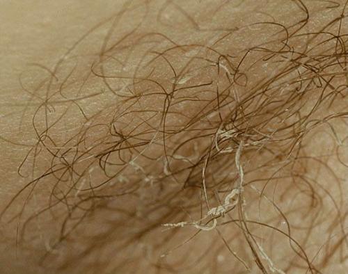 Красные на пальцах пятна. Определение болезни. Причины заболевания 02 Красные на пальцах пятна. Определение болезни. Причины заболевания 02