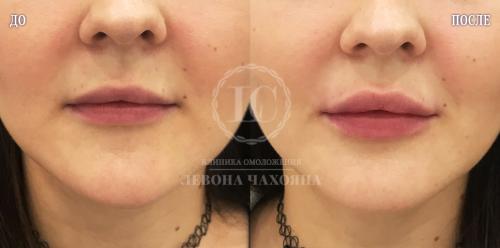 Губы. Статистика, золотое сечение и наука.