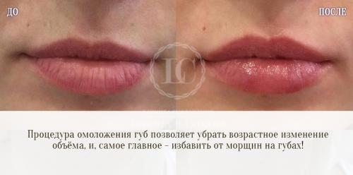 Губы. Статистика, золотое сечение и наука.