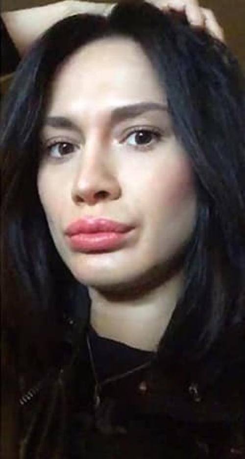 Блеск для губ с эффектом объема. Что такое плампер для губ? 25