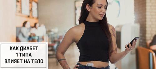 Как похудеть при сахарном диабете 1 и 2 типа. Как похудеть при диабете 2 типа 06 Как похудеть при сахарном диабете 1 и 2 типа. Как похудеть при диабете 2 типа 06