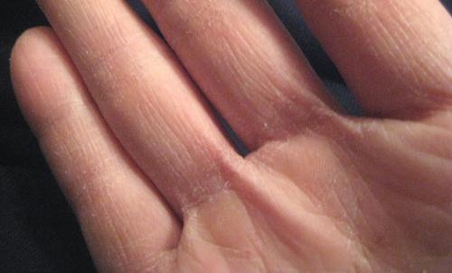 Гигиеническая косметика с глицерином: как правильно выбрать крем для лица и рук 01 Гигиеническая косметика с глицерином: как правильно выбрать крем для лица и рук 01