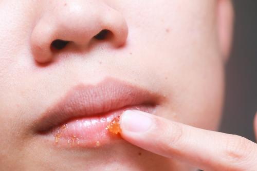 Какие ингредиенты можно использовать для приготовления отшелушивающего скраба для губ. 16 рецептов, как сделать скраб для губ в домашних условиях своими руками или какой из 5 купить