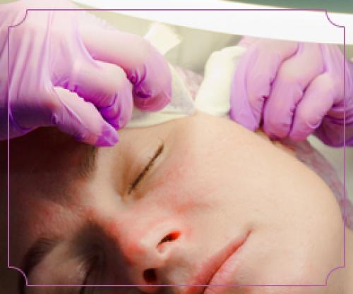 Механическая чистка лица этапы. Механическая чистка лица: чистая и сияющая кожа