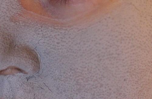 Для чего необходимо глубокое очищение кожи лица. Когда и зачем нужно 13 Для чего необходимо глубокое очищение кожи лица. Когда и зачем нужно 13