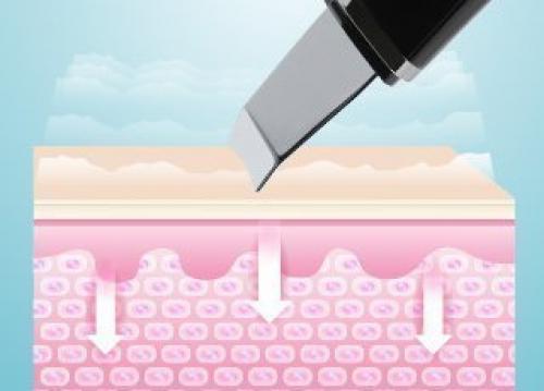 Глубокое очищение кожи лица в салоне. Что такое ультразвуковая чистка лица?