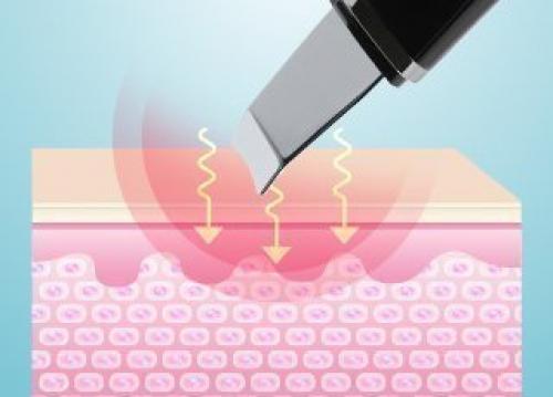 Аппаратная чистка лица. Что такое ультразвуковая чистка лица?