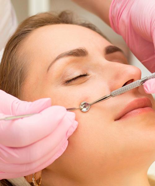 Как безопасно чистить лицо в домашних условиях. Основные опасности домашней чистки лица: 02 Как безопасно чистить лицо в домашних условиях. Основные опасности домашней чистки лица: 02