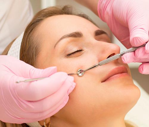 Как безопасно чистить лицо в домашних условиях. Основные опасности домашней чистки лица: 03 Как безопасно чистить лицо в домашних условиях. Основные опасности домашней чистки лица: 03