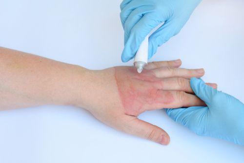 Как избавиться от прыщей на спине. Почему появляются прыщи на спине: основные причины 02 Как избавиться от прыщей на спине. Почему появляются прыщи на спине: основные причины 02