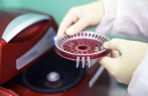 Россия разработала пять прототипов вакцины от коронавируса 02 Россия разработала пять прототипов вакцины от коронавируса 02