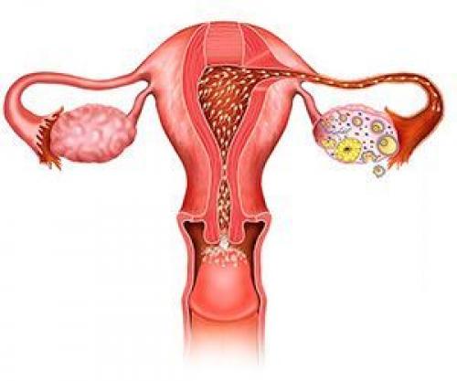 Дисплазия код по мк. Степени дисплазии 01 Дисплазия код по мк. Степени дисплазии 01