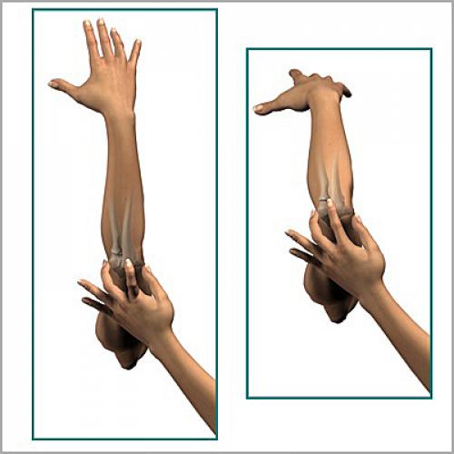 Какие физические упражнения могут укреплять локтевой сустав