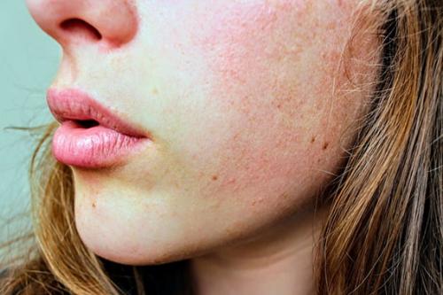 6 этапов правильной чистки лица. Что такое ультразвуковая чистка лица? 07