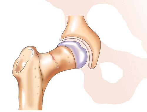 Как понять, что сломана рука ниже локтя. Определение болезни. Причины заболевания 05
