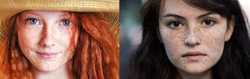 Как убрать пигментные пятна. Как удалить пигментацию на лице 04