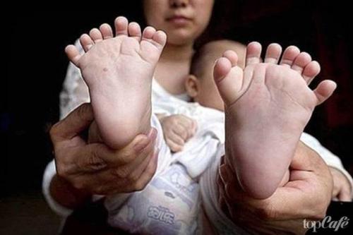 Причины быстрого набора веса у женщин. Причины появления лишнего веса