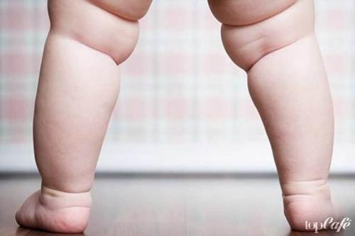 Причины быстрого набора веса у женщин. Причины появления лишнего веса