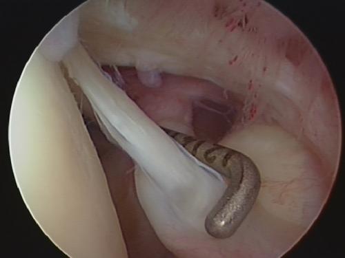В статье рассматривается анатомия плечевого сустава. Анатомия плечевого сустава 01 В статье рассматривается анатомия плечевого сустава. Анатомия плечевого сустава 01