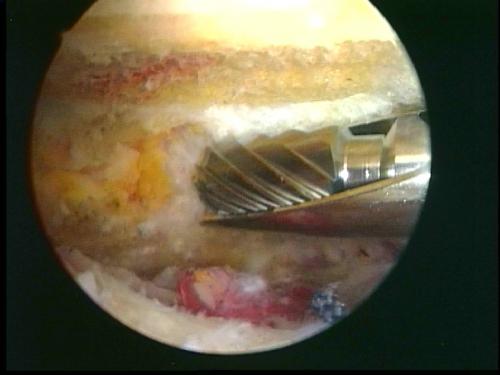 В статье рассматривается анатомия плечевого сустава. Анатомия плечевого сустава 02 В статье рассматривается анатомия плечевого сустава. Анатомия плечевого сустава 02