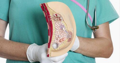 Лечение диффузной фиброзно-кистозной мастопатии. Классификация и стадии развития мастопатии 01