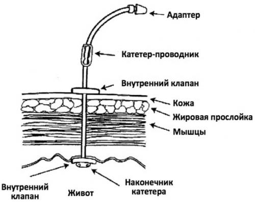 Как избежать повреждения продуктов при их хранении в гипертостопе