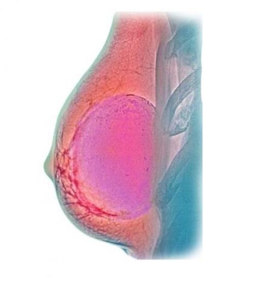 Малая грудь: как сделать ее больше и красивее 03