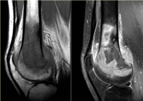 Полное руководство по таблице анатомии суставов: основные структуры и функции 13 Полное руководство по таблице анатомии суставов: основные структуры и функции 13