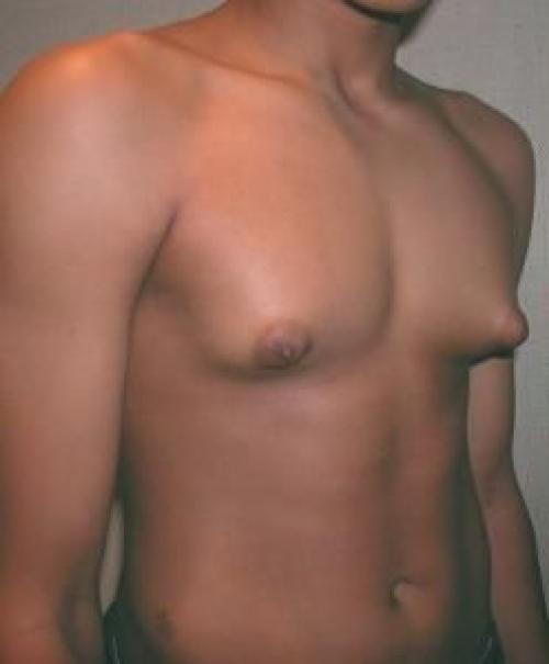 Пролактин в мужском организме. Определение болезни. Причины заболевания 09 Пролактин в мужском организме. Определение болезни. Причины заболевания 09