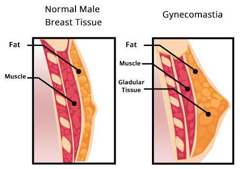 Пролактин в мужском организме. Определение болезни. Причины заболевания 08 Пролактин в мужском организме. Определение болезни. Причины заболевания 08