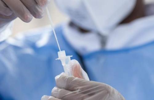 Почему многие люди набирают лишний вес после перенесенного коронавируса 01 Почему многие люди набирают лишний вес после перенесенного коронавируса 01