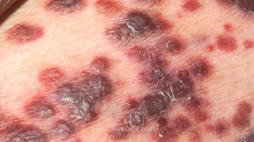 Как правильно защитить себя от коронавируса COVID-19 01