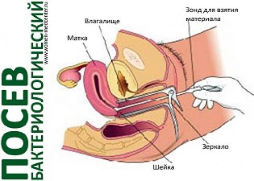 Важность регулярных осмотров: как профилактика способствует сохранению женского здоровья 05 Важность регулярных осмотров: как профилактика способствует сохранению женского здоровья 05