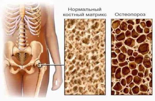 Какие научные исследования подтверждают эффективность желатина при артрозе коленного сустава. Что говорят результаты медицинских исследований
