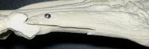 Деформация тейлора