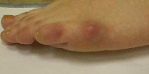 Деформация тейлора