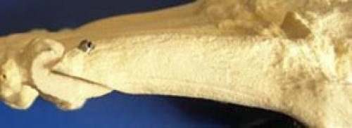 Деформация тейлора