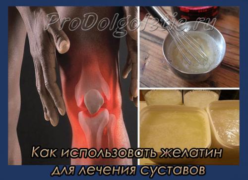 Как хранить приготовленный компресс из желатина для повторного использования. Как использовать желатин для лечения суставов