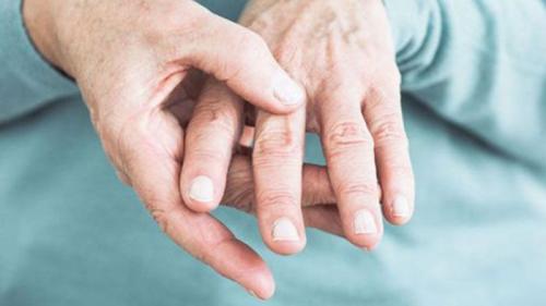 Воспаление суставов пальцев рук+народные средства. Признаки подагры кистей и пальцев