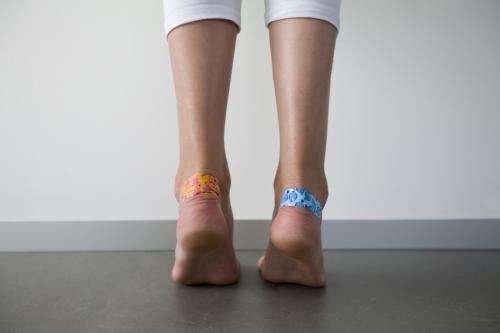 Шишка на пальце ноги похожая на мозоль, как убрать. Лопнула мозоль на ноге